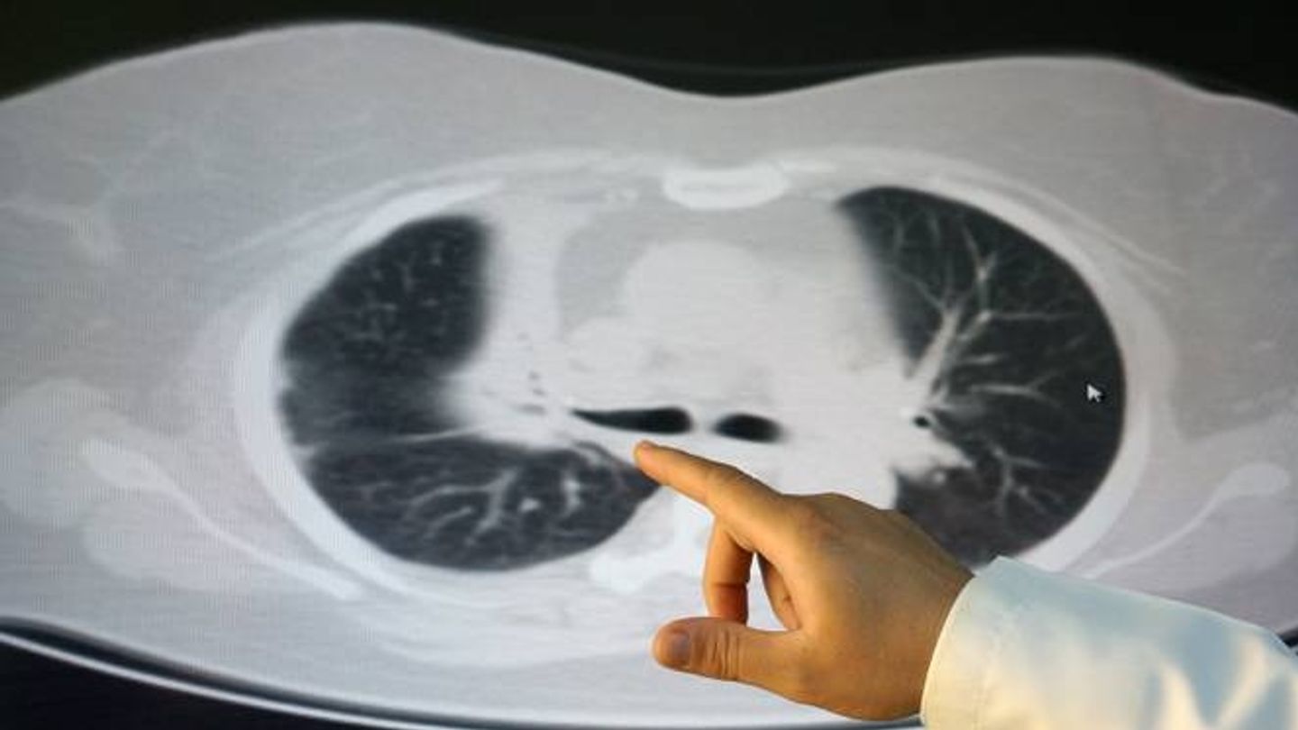 Turkish expert develops ‘Transparent imaging’ technology for the cancer